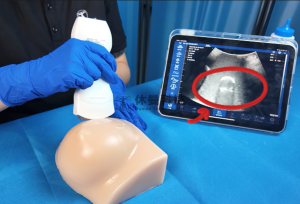用于外科培训与患者教育的3D打印肿瘤触诊模型的开发与评价