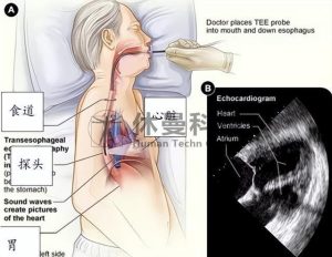优化基于模拟器的急诊经食管超声心动图培训：一项随机对照试验