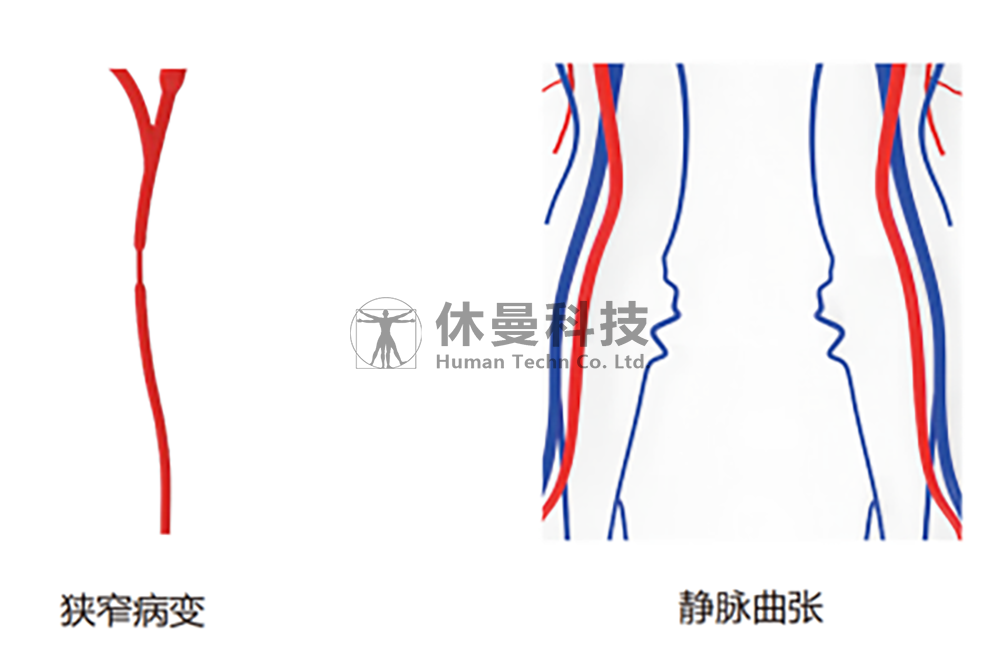 病理模块