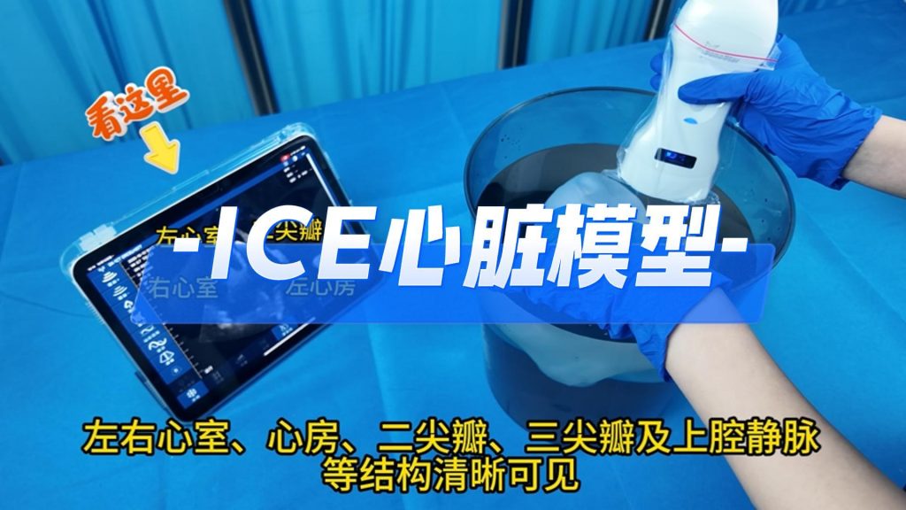 ICE心脏模型