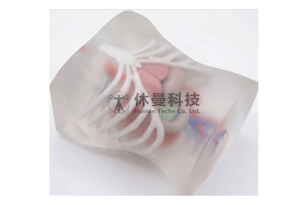 超声引导下腹部肿物穿刺综合模型