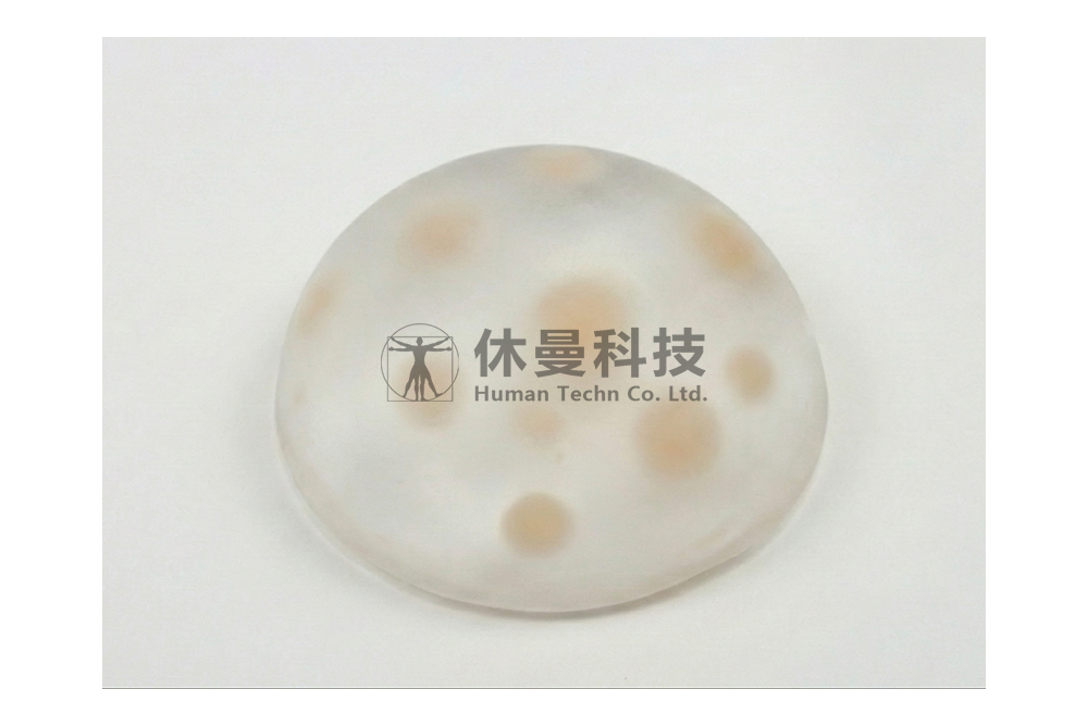 超声引导下乳腺肿物穿刺和消融术模型