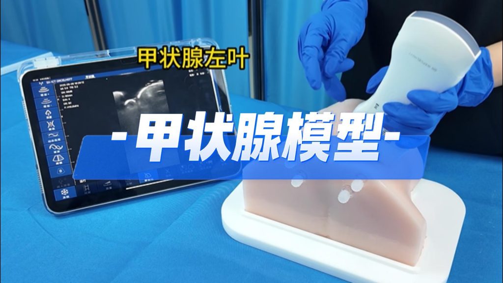 甲状腺模型