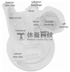 新型3D打印模拟器在提升术者二尖瓣经导管缘对缘修复术操作信心与技能中的有效性