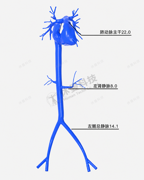 肺动脉栓塞模型